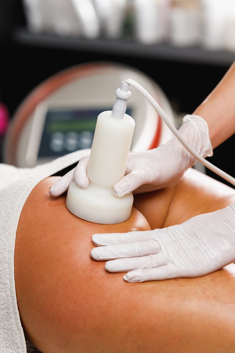 Ultrasound Cavitation Body Contouring Treatment